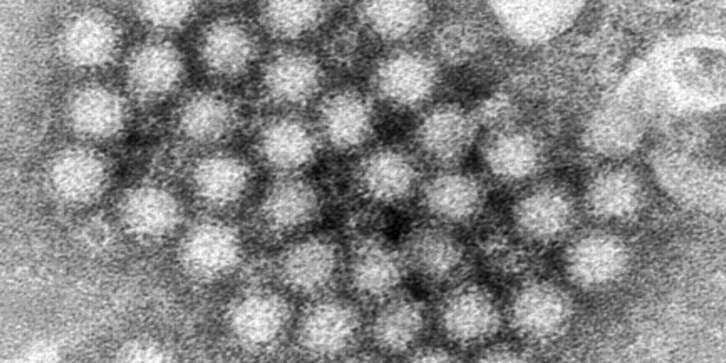 Kasus norovirus melonjak di seluruh AS dan 40% di atas angka tertinggi sepanjang tahun ini