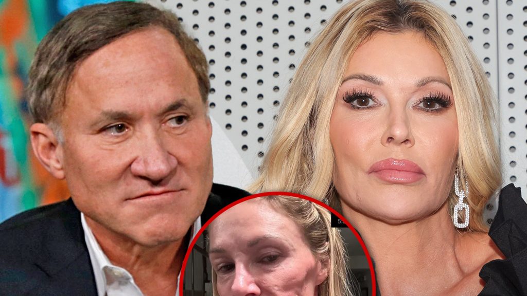 Terry Dubrow Mungkin Menyarankan Operasi untuk Brandi Glanville, Dia Ingin Wajahnya Kembali