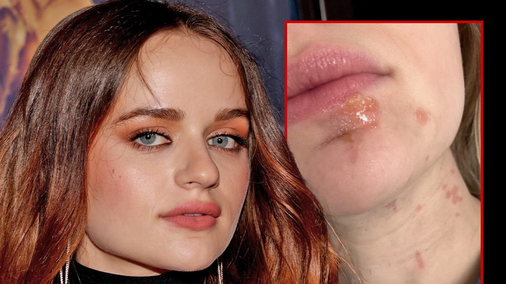 Joey King berakhir dengan luka bakar wajah saat memasak bawang merah dengan minyak panas